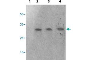 Western blot analysis of Lane 1: antigen-specific peptide treated 293 cells, Lane 2: 293 cells, Lane 3: HeLa cells, Lane 4: HepG2 cells with GAB2 (phospho S623) polyclonal antibody  at 1:500-1000 dilution. (GAB2 antibody  (pSer623))