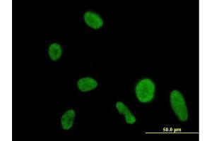 Immunofluorescence of purified MaxPab antibody to DIP2A on HeLa cell. (DIP2A antibody  (AA 1-889))