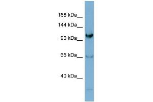 WB Suggested Anti-GEMIN4  Antibody Titration: 0. (GEMIN4 antibody  (N-Term))