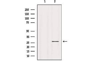 Western blot analysis of extracts from B16F10, using ASF1B Antibody.