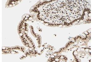 ABIN6266651 at 1/100 staining human colon tissue sections by IHC-P. (NCOR1 antibody  (N-Term))