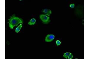 Immunofluorescence staining of MCF-7 cells with ABIN7146799 at 1:133, counter-stained with DAPI. (CEACAM5 antibody  (AA 1-255))