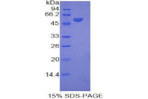 SDS-PAGE (SDS) image for Kinesin Family Member 5A (KIF5A) (AA 823-1027) protein (His tag,GST tag) (ABIN2123128) (KIF5A Protein (AA 823-1027) (His tag,GST tag))