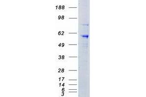 Western Blotting (WB) image for serine threonine Kinase 39 (STK39) protein (Myc-DYKDDDDK Tag) (ABIN2712376)