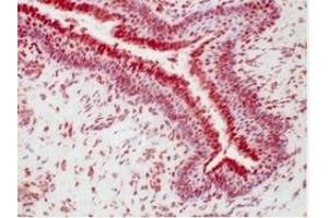 Immunohistochemistry (IHC) image for anti-Progesterone Receptor (PGR) (AA 922-933), (C-Term) antibody (ABIN781660) (Progesterone Receptor antibody  (C-Term))