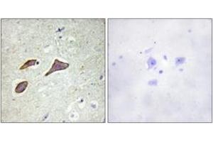 Immunohistochemistry analysis of paraffin-embedded human brain, using Nonvoltage-gated Sodium Channel 1 (Phospho-Thr615) Antibody. (Nonvoltage-Gated Sodium Channel 1 (AA 581-630), (pThr615) antibody)