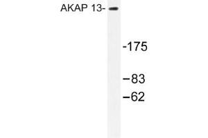 Image no. 1 for anti-A Kinase (PRKA) Anchor Protein 13 (AKAP13) antibody (ABIN317612) (AKAP13 antibody)