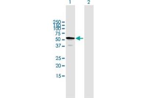 Western Blot analysis of TBC1D22B expression in transfected 293T cell line by TBC1D22B MaxPab polyclonal antibody.