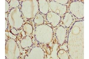 Immunohistochemistry of paraffin-embedded human thyroid tissue using ABIN7153105 at dilution of 1:100 (FOXR2 antibody  (AA 1-300))