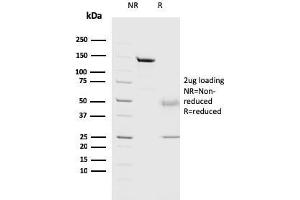 SDS-PAGE (SDS) image for anti-Cathepsin D (CTSD) (AA 104-250) antibody (ABIN6939215)