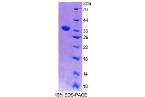 SDS-PAGE analysis of Rat PLCe1 Protein. (PLCE1 Protein)
