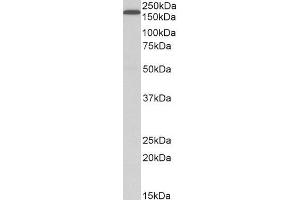 ABIN185410 (1µg/ml) staining of HepG2 lysate (35µg protein in RIPA buffer). (LRP5 antibody  (Internal Region))
