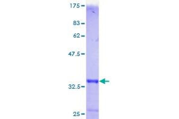 MT1F Protein (AA 1-61) (GST tag)