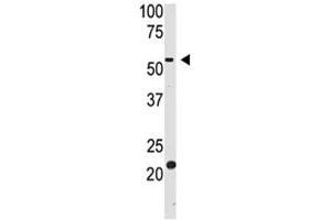 Western blot testing of BACE2 antibody and HL-60 cell lysate (BACE2 antibody  (AA 336-365))