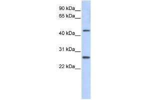 WB Suggested Anti-PRAMEF10 Antibody Titration: 0. (PRAMEF10 antibody  (Middle Region))
