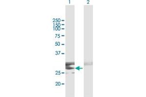Western Blot analysis of CLEC9A expression in transfected 293T cell line by CLEC9A MaxPab polyclonal antibody. (CLEC9A antibody  (AA 1-241))