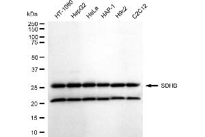 Western blotting analysis using SDHB antibody (ABIN7800454).