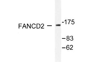 Image no. 3 for anti-Fanconi Anemia, Complementation Group D2 (FANCD2) antibody (ABIN265413) (FANCD2 antibody)