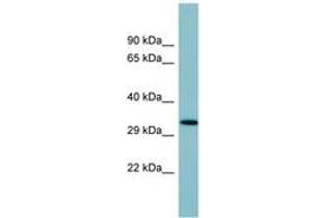 Image no. 1 for anti-Surfactant Protein D (SFTPD) (AA 107-156) antibody (ABIN6741645) (SFTPD antibody  (AA 107-156))