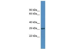 WB Suggested Anti-Auh Antibody Titration:  0. (AUH antibody  (N-Term))