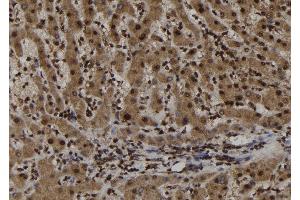 ABIN6273021 at 1/100 staining Human liver tissue by IHC-P. (TRIM44 antibody  (Internal Region))