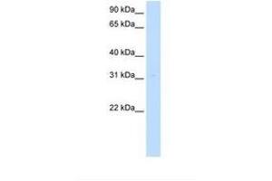 Image no. 1 for anti-Myeloid Leukemia Factor 2 (MLF2) (AA 143-192) antibody (ABIN321124) (MLF2 antibody  (AA 143-192))