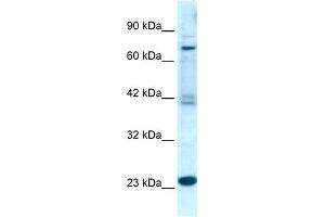 WB Suggested Anti-RGS10  Antibody Titration: 0. (RGS10 antibody  (Middle Region))