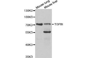 Western blot analysis of extracts of various cell lines, using TGFBI antibody. (TGFBI antibody  (AA 481-683))