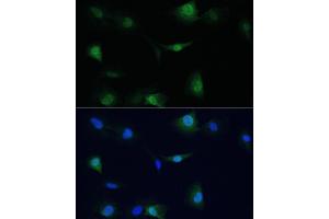 Immunofluorescence analysis of C6 cells using VCP antibody (ABIN6128632, ABIN6150072, ABIN6150073 and ABIN6217335) at dilution of 1:100. (VCP antibody  (AA 647-806))