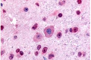 Mouse, Brain (formalin-fixed, paraffin-embedded) stained with GLI2 antibody ABIN214612 at 5 ug/ml followed by biotinylated goat anti-rabbit IgG secondary antibody ABIN481713, alkaline phosphatase-streptavidin and chromogen. (GLI2 antibody  (Internal Region))