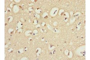 Immunohistochemistry of paraffin-embedded human brain tissue using ABIN7156852 at dilution of 1:100 (IL21 Receptor antibody  (AA 20-240))