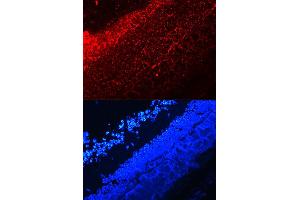 Immunofluorescence (IF) image for anti-Interleukin 17A (IL17A) (AA 24-155) antibody (ABIN3021082) (Interleukin 17a antibody  (AA 24-155))