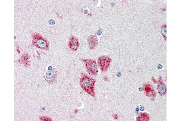 ANKH antibody  (AA 464-492)