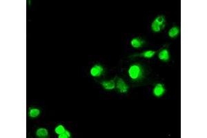 Anti-SATB1 mouse monoclonal antibody (ABIN2452372) immunofluorescent staining of COS7 cells transiently transfected by pCMV6-ENTRY SATB1 (RC200421). (SATB1 antibody)