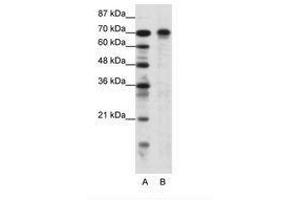 Image no. 1 for anti-Hypermethylated in Cancer 1 (HIC1) (AA 209-258) antibody (ABIN6736116) (HIC1 antibody  (AA 209-258))