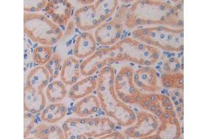 Figure. (Myosin IC antibody  (AA 728-987))