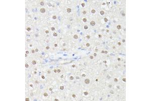 Immunohistochemistry of paraffin-embedded rat liver using MLF2 antibody (ABIN7268725) at dilution of 1:100 (40x lens). (MLF2 antibody  (AA 1-65))