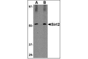 Western blot analysis of SIRT2 in Mouse brain lysate with SIRT2 antibody at (A) 1 and (B) 2 µg/ml. (SIRT2 antibody  (C-Term))