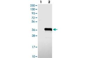 Western blot analysis of Lane 1: Negative control (vector only transfected HEK293T lysate), Lane 2: Over-expression Lysate (Co-expressed with a C-terminal myc-DDK tag (~3. (TYW3 antibody)