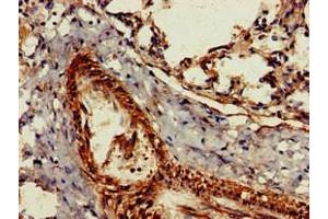 Immunohistochemistry of paraffin-embedded human lung tissue using ABIN7154420 at dilution of 1:100