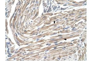 MGST2 antibody was used for immunohistochemistry at a concentration of 4-8 ug/ml to stain Skeletal muscle cells (arrows) in Human Muscle. (MGST2 antibody  (N-Term))
