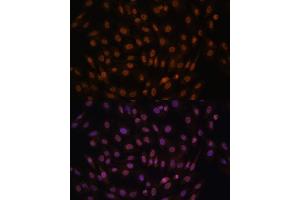 Immunofluorescence analysis of C6 cells using FCF1 antibody (ABIN7267162) at dilution of 1:100. (FCF1 antibody)