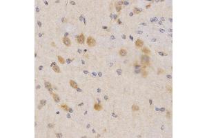 Immunohistochemistry (IHC) image for anti-3-phosphoinositide Dependent Protein Kinase-1 (PDPK1) (AA 150-429) antibody (ABIN3022352) (PDPK1 antibody  (AA 150-429))