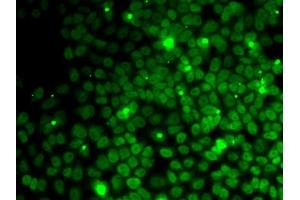 Immunofluorescence analysis of MCF7 cells using UFD1L antibody (ABIN1683208, ABIN5664259, ABIN5664261 and ABIN6220174). (UFD1L antibody  (AA 1-307))