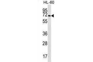 Western Blotting (WB) image for anti-Solute Carrier Family 6 (Amino Acid Transporter), Member 14 (Slc6a14) antibody (ABIN2997057)