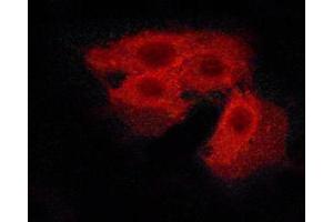 ABIN6267505 staining Hela cells by ICC/IF. (CASR antibody  (pThr888))