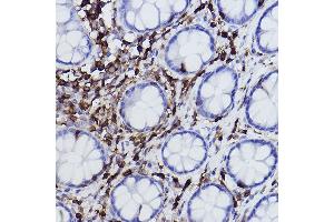 Immunohistochemistry of paraffin-embedded human colon using L-Plastin/LCP1 Rabbit mAb (ABIN7268317) at dilution of 1:100 (40x lens). (LCP1 antibody)