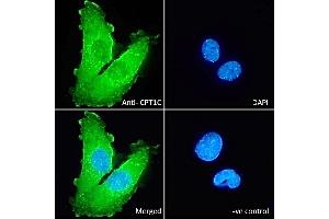 (ABIN570939) Immunofluorescence analysis of paraformaldehyde fixed U251 cells, permeabilized with 0. (CPT1C antibody  (Internal Region))