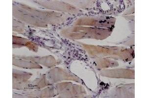 Expression of RyR1 in rat skeletal muscle - Immunohistochemical staining of paraffin embedded sections of rat quadriceps using Anti-Ryanodine Receptor 1 Antibody (ABIN7043604, ABIN7045211 and ABIN7045212), (1:100). (RYR1 antibody  (Intracellular, N-Term))