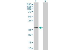 Western Blot analysis of DCI expression in transfected 293T cell line by DCI MaxPab polyclonal antibody. (DCI antibody  (AA 1-243))